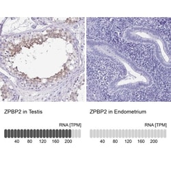 ZPBP2 Antibody, Novus Biologicals 25 &mu;L, Unlabeled:Antibodies, Polyclonal